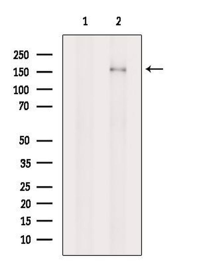 NPHP4 Antibody in Western Blot (WB)