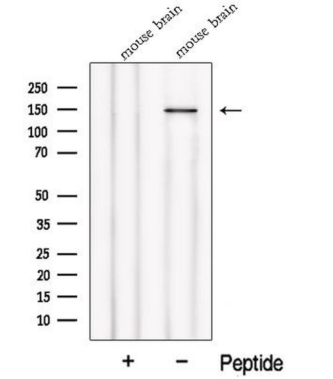 NPHP4 Antibody in Western Blot (WB)