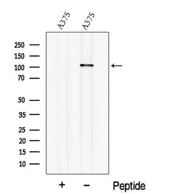 OSMR Antibody in Western Blot (WB)