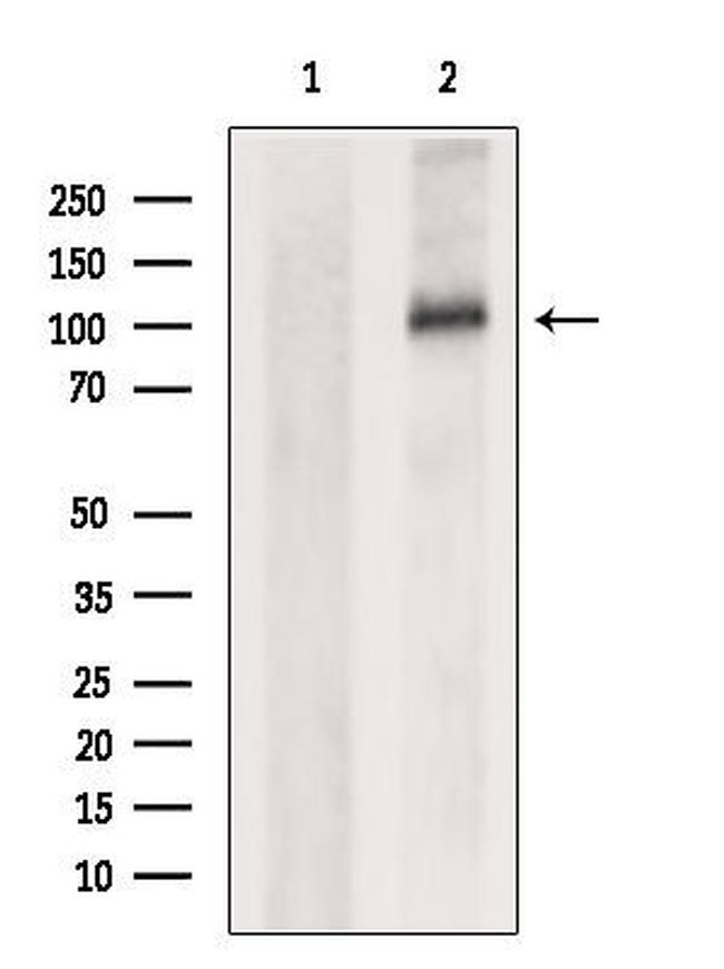 OSMR Antibody in Western Blot (WB)