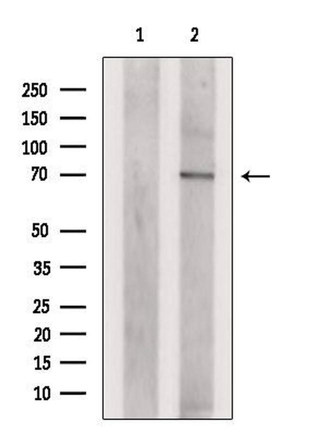 PLAGL2 Antibody in Western Blot (WB)