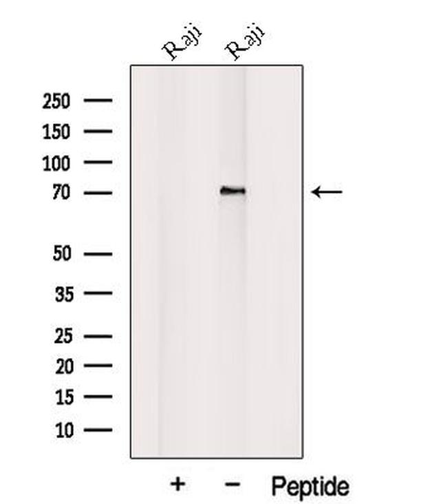 PLAGL2 Antibody in Western Blot (WB)