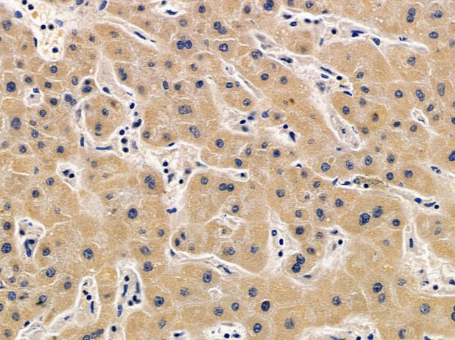 PTPRS Antibody in Immunohistochemistry (Paraffin) (IHC (P))