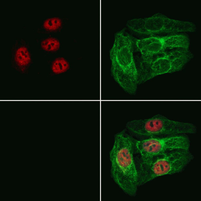 RABL3 Antibody in Immunocytochemistry (ICC/IF)