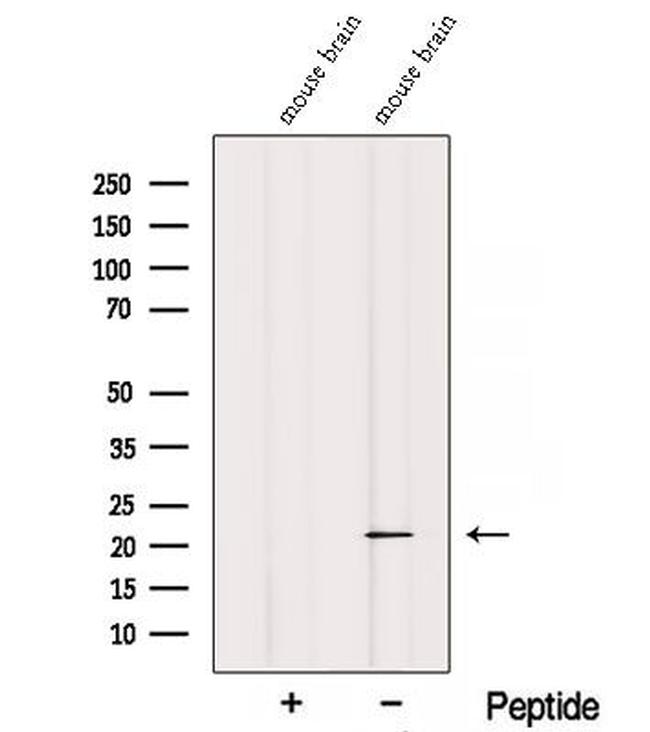 REEP1 Antibody in Western Blot (WB)