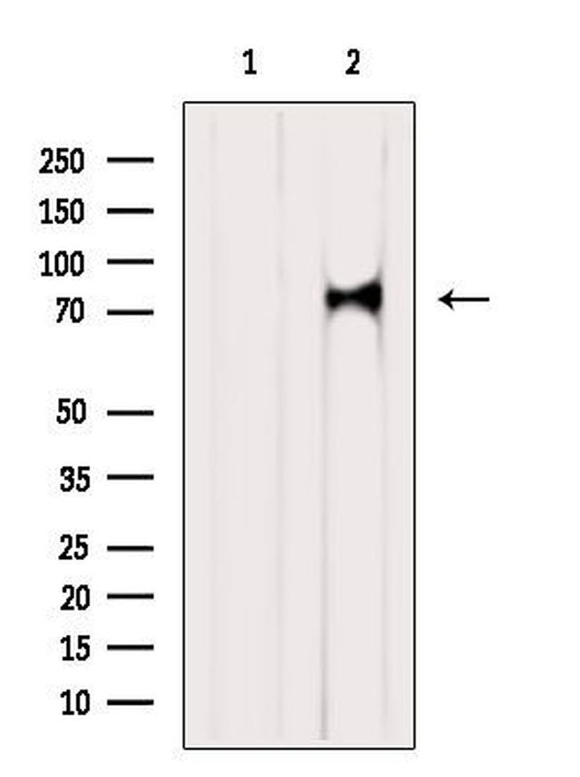 RNF12 Antibody in Western Blot (WB)