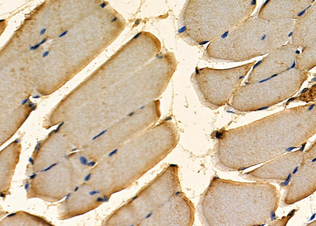 RSPO3 Antibody in Immunohistochemistry (Paraffin) (IHC (P))