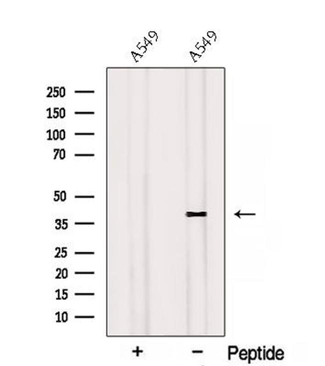 RSPO3 Antibody in Western Blot (WB)