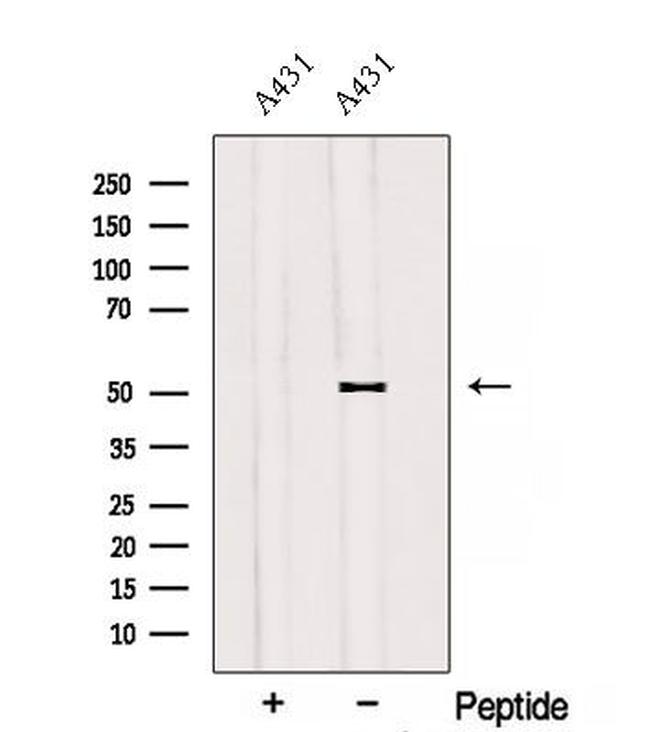 SAMM50 Antibody in Western Blot (WB)