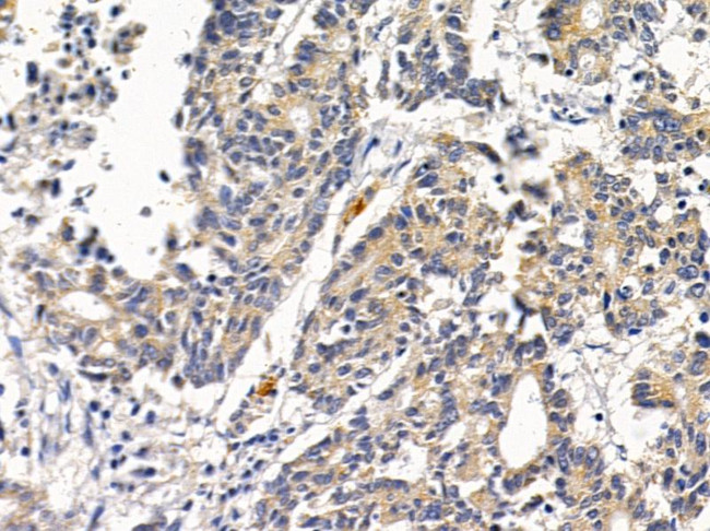 SCO2 Antibody in Immunohistochemistry (Paraffin) (IHC (P))