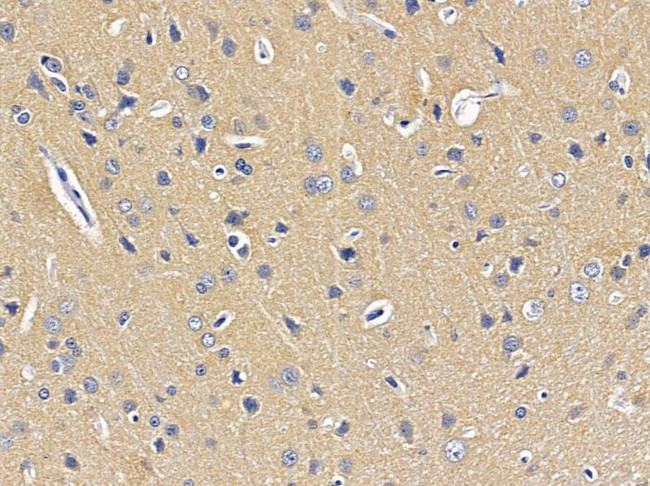 SCO2 Antibody in Immunohistochemistry (Paraffin) (IHC (P))