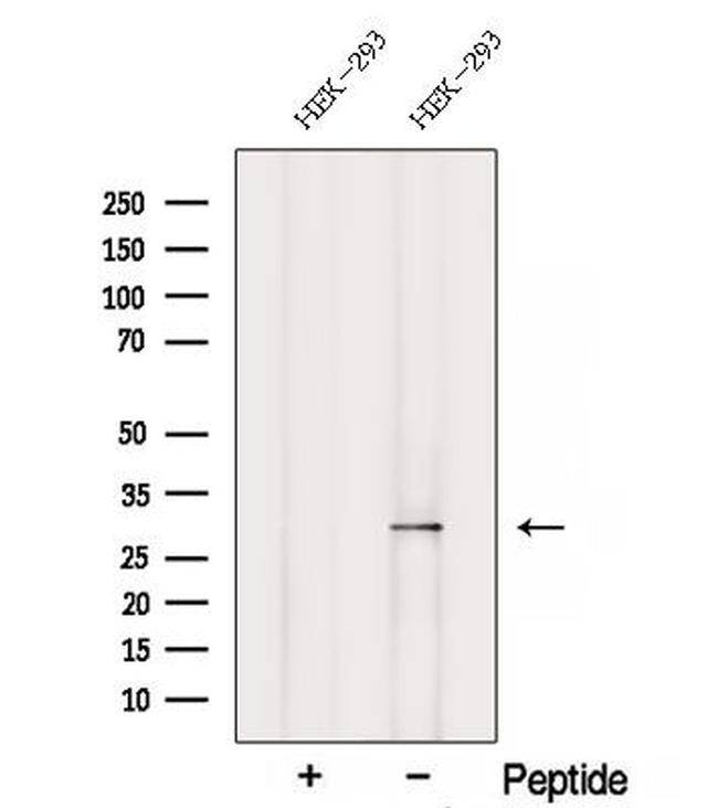 SCO2 Antibody in Western Blot (WB)