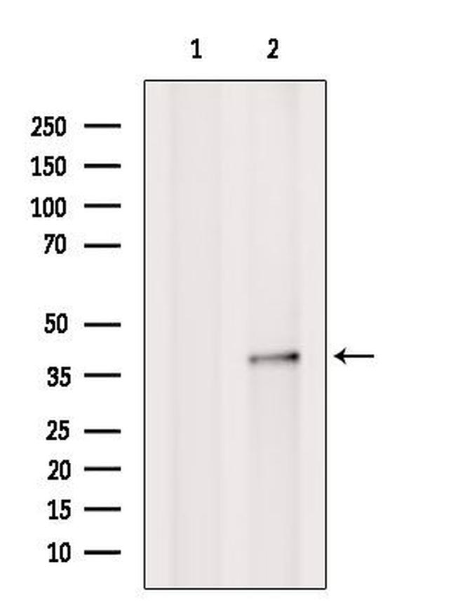 SCO2 Antibody in Western Blot (WB)