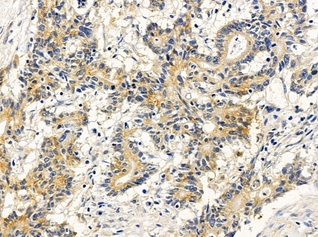 SGMS1 Antibody in Immunohistochemistry (Paraffin) (IHC (P))