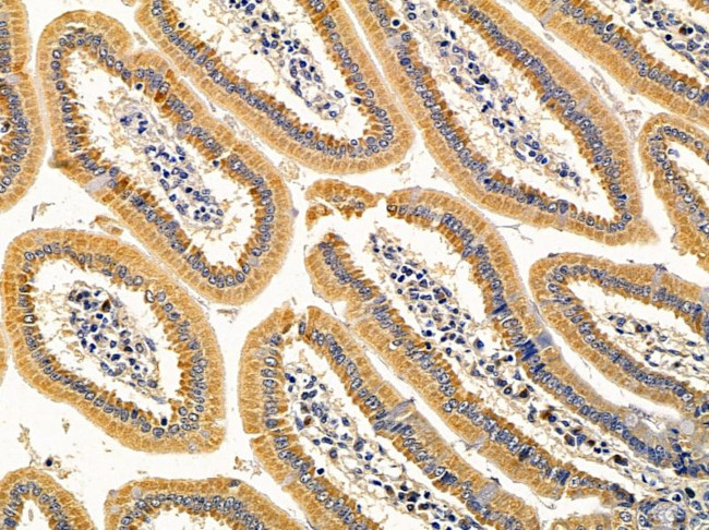 SGMS1 Antibody in Immunohistochemistry (Paraffin) (IHC (P))