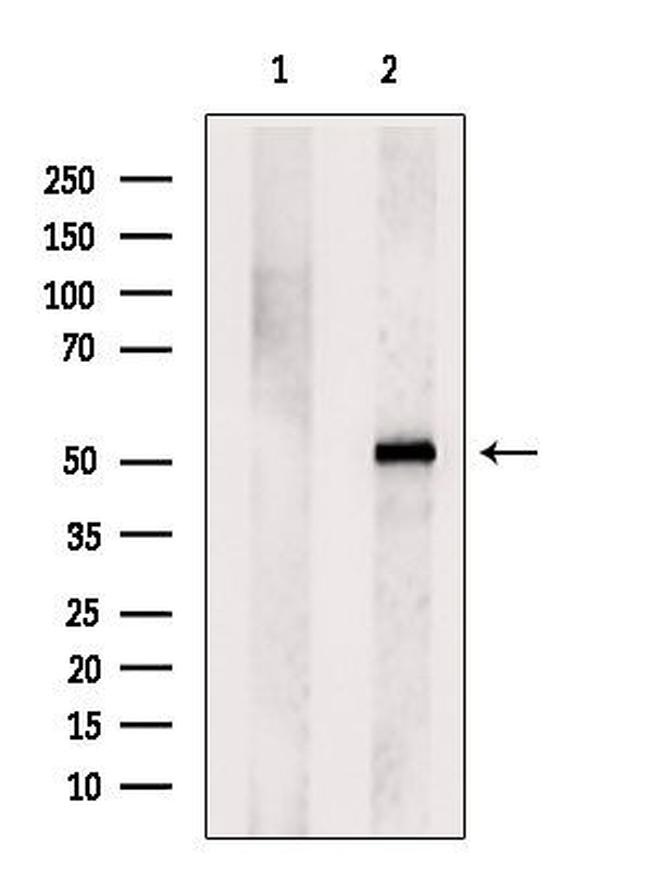 SGMS1 Antibody in Western Blot (WB)