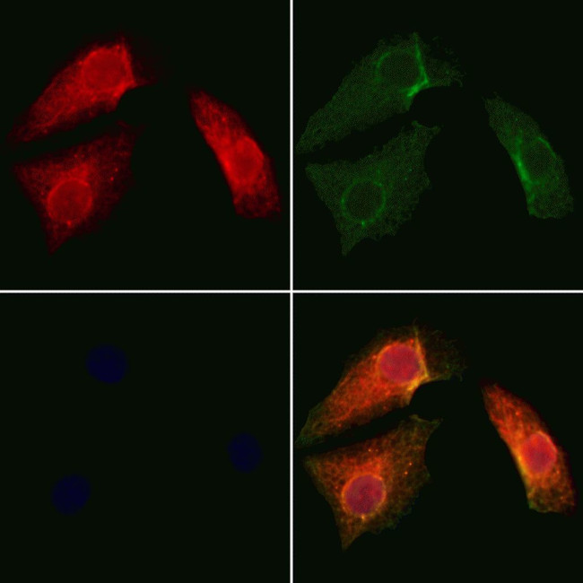 SAB Antibody in Immunocytochemistry (ICC/IF)