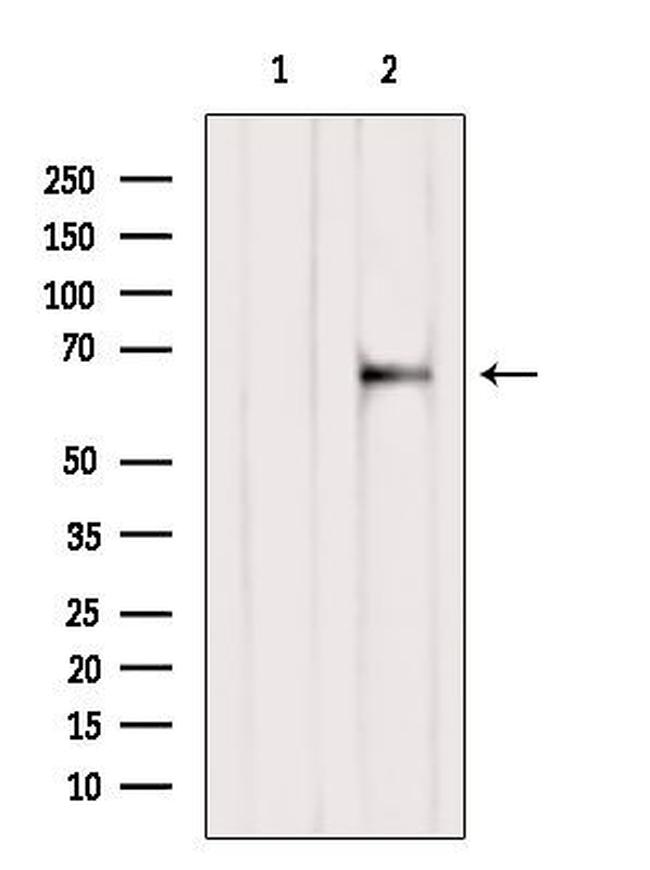 SLC19A3 Antibody in Western Blot (WB)