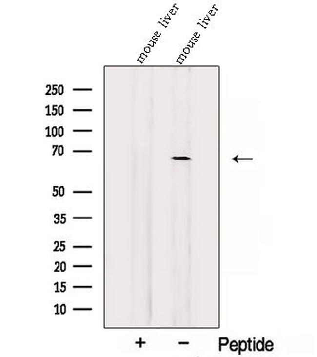 SLC19A3 Antibody in Western Blot (WB)