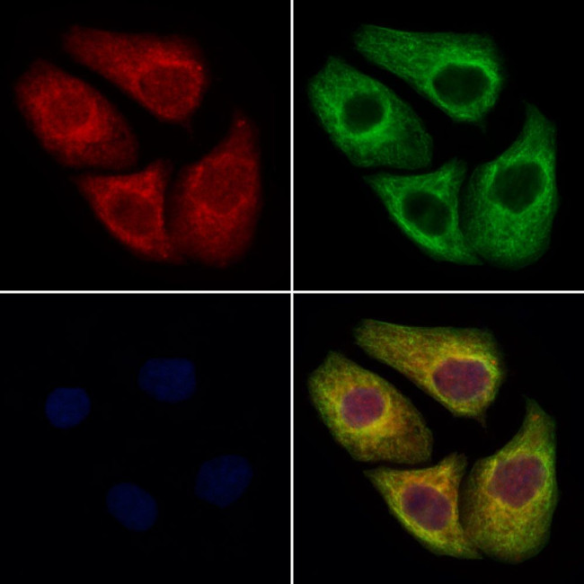 TBCE Antibody in Immunocytochemistry (ICC/IF)