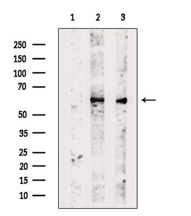 TBCE Antibody in Western Blot (WB)