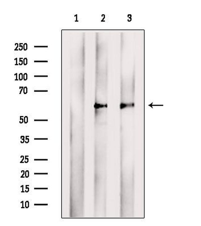 TCN2 Antibody in Western Blot (WB)