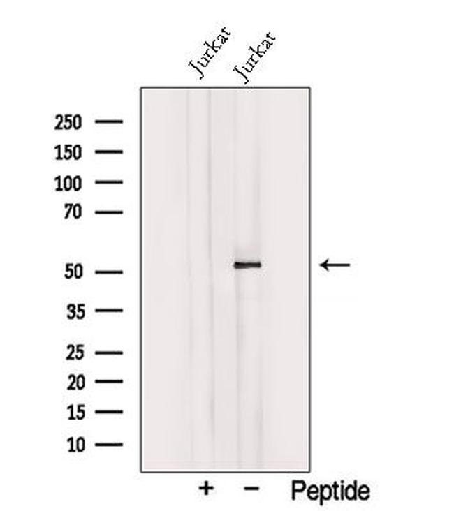 TRIM15 Antibody in Western Blot (WB)