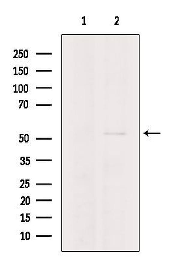 TRIM15 Antibody in Western Blot (WB)