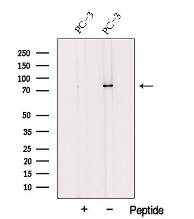 TRPV6 Antibody in Western Blot (WB)