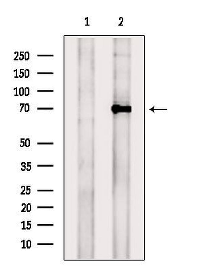 TRPV6 Antibody in Western Blot (WB)