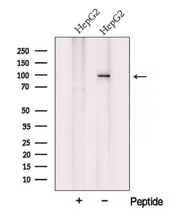 VPS35 Antibody in Western Blot (WB)