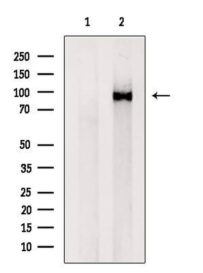 VPS35 Antibody in Western Blot (WB)