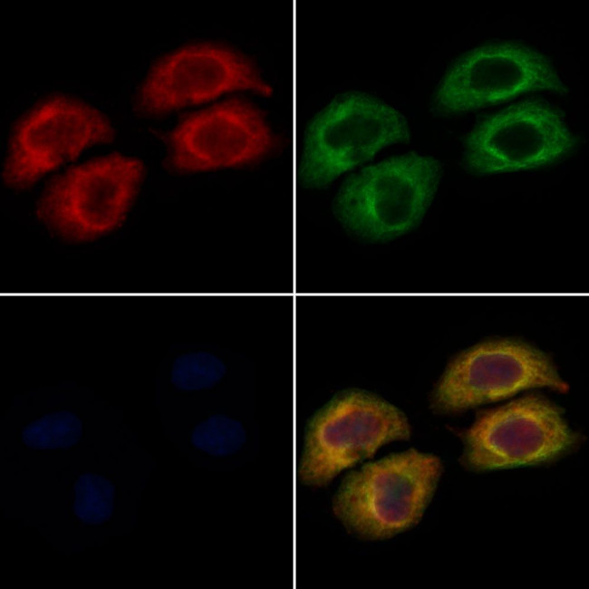 VPS41 Antibody in Immunocytochemistry (ICC/IF)