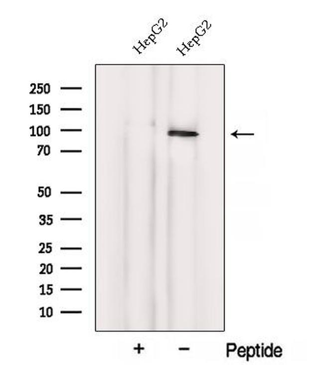 VPS41 Antibody in Western Blot (WB)