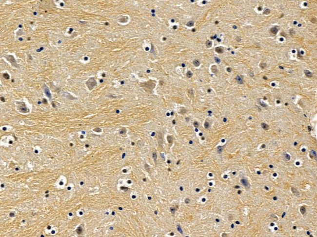 XPO6 Antibody in Immunohistochemistry (Paraffin) (IHC (P))