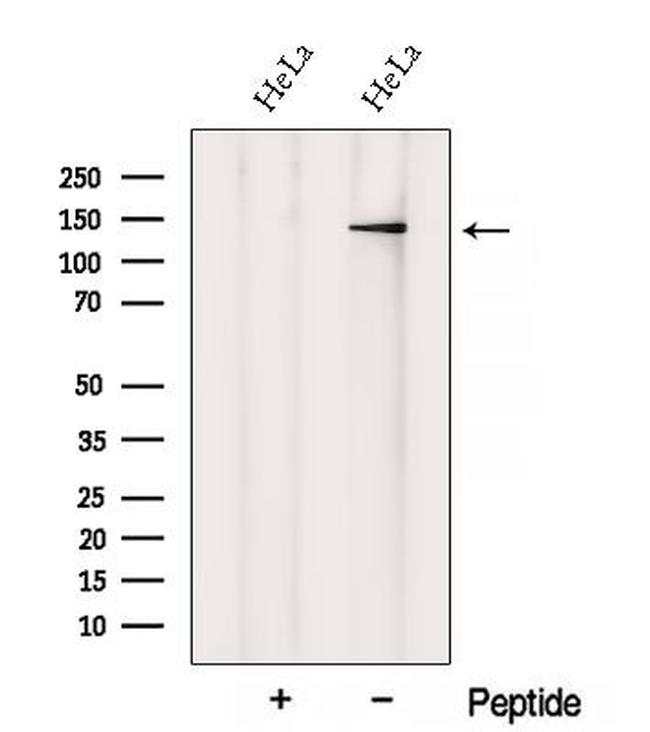 XPO6 Antibody in Western Blot (WB)