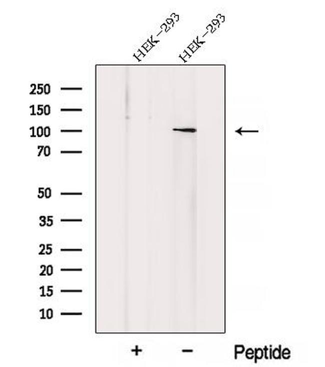 ZHX1 Antibody in Western Blot (WB)