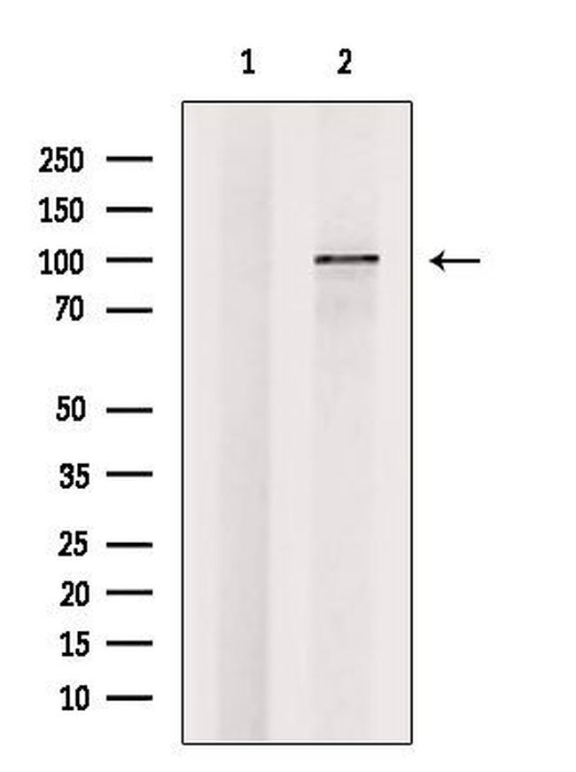 ZHX1 Antibody in Western Blot (WB)