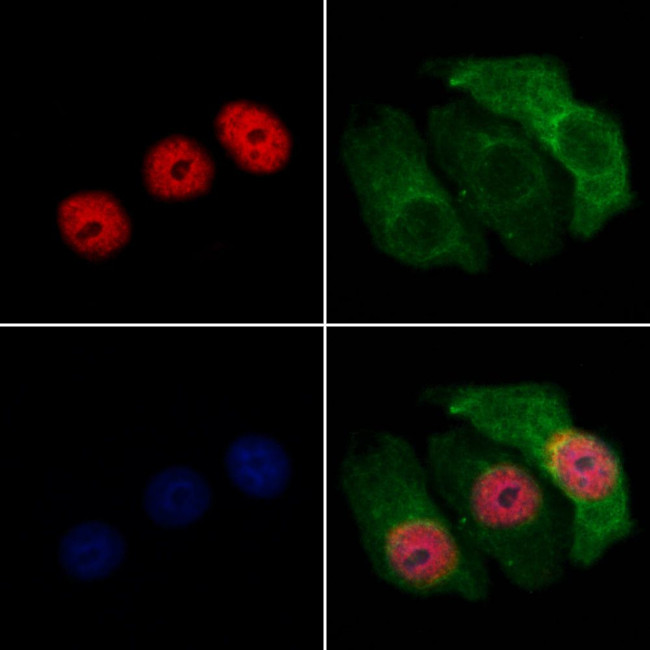 ZNF238 Antibody in Immunocytochemistry (ICC/IF)