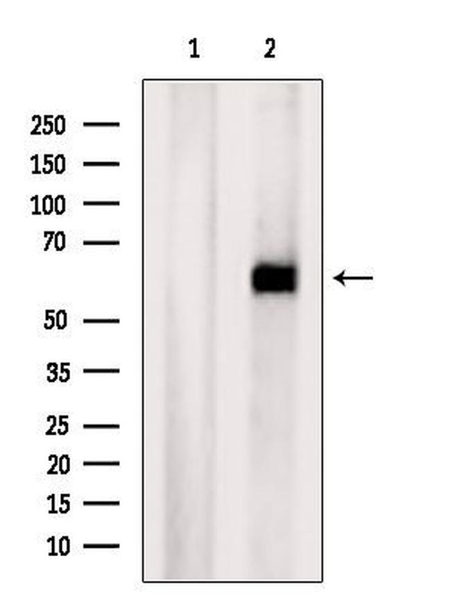 ZNF238 Antibody in Western Blot (WB)