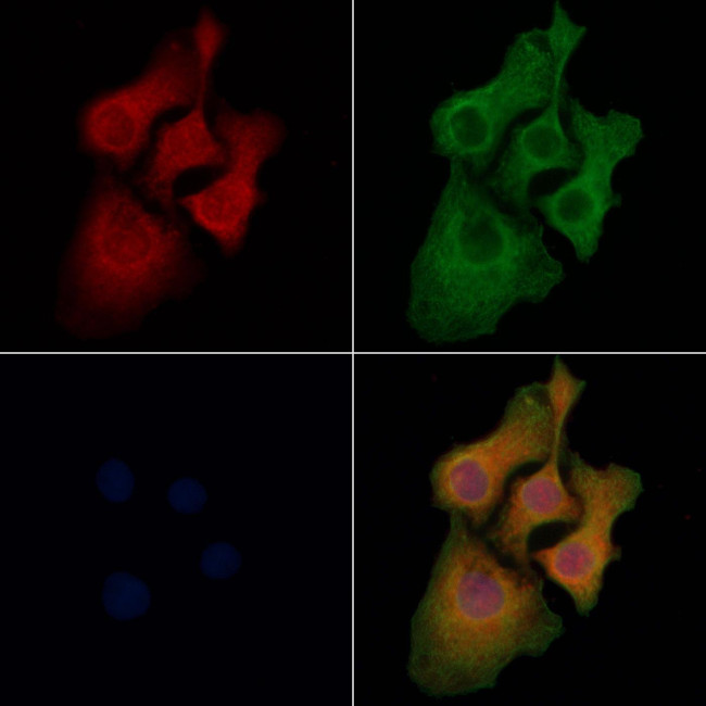 SOAT2 Antibody in Immunocytochemistry (ICC/IF)