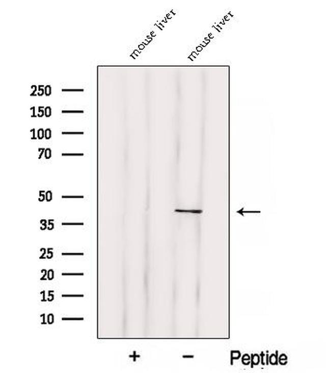 SOAT2 Antibody in Western Blot (WB)