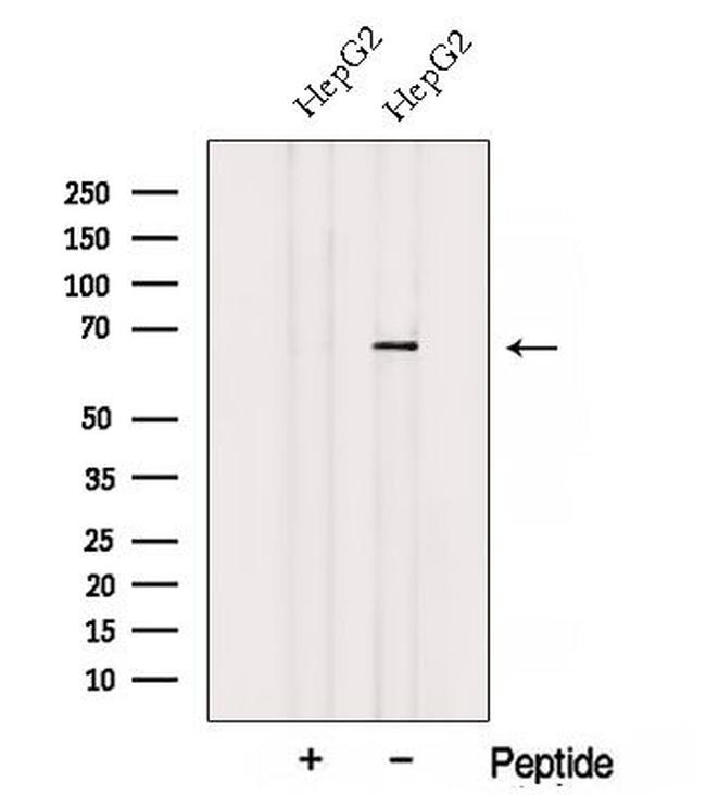 ACSM3 Antibody in Western Blot (WB)