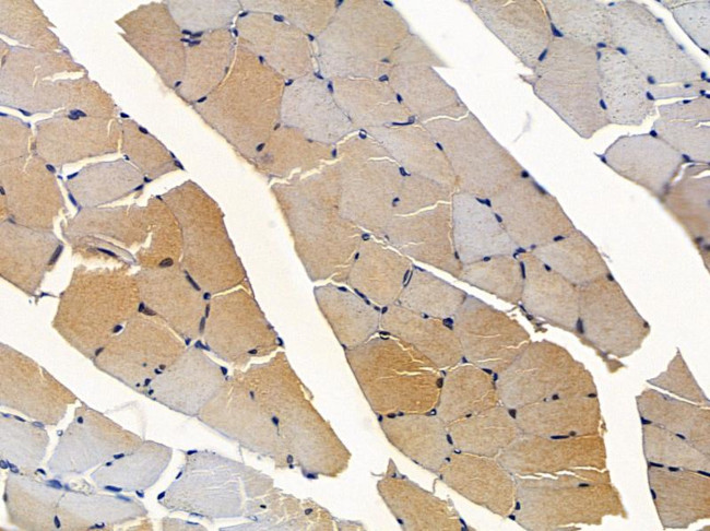 Adiponectin Receptor 2 Antibody in Immunohistochemistry (Paraffin) (IHC (P))