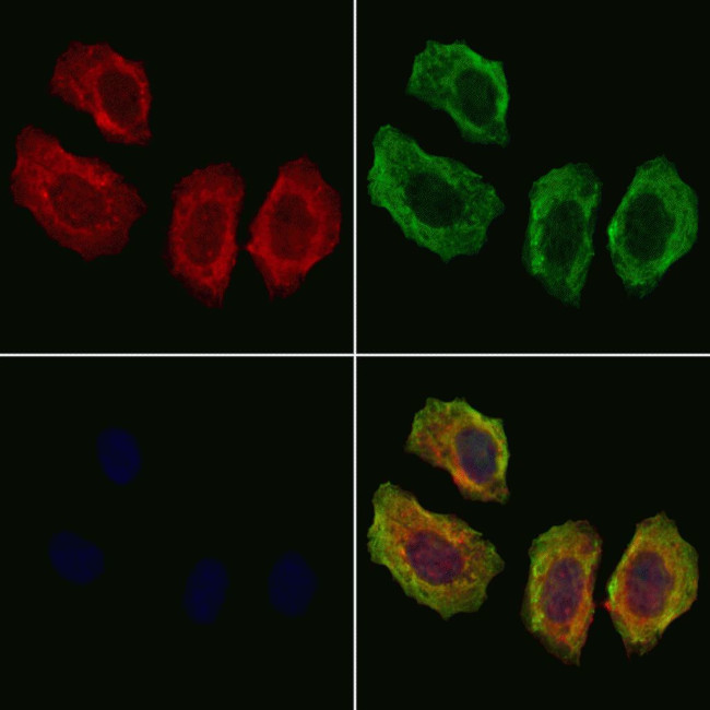 AFAP Antibody in Immunocytochemistry (ICC/IF)