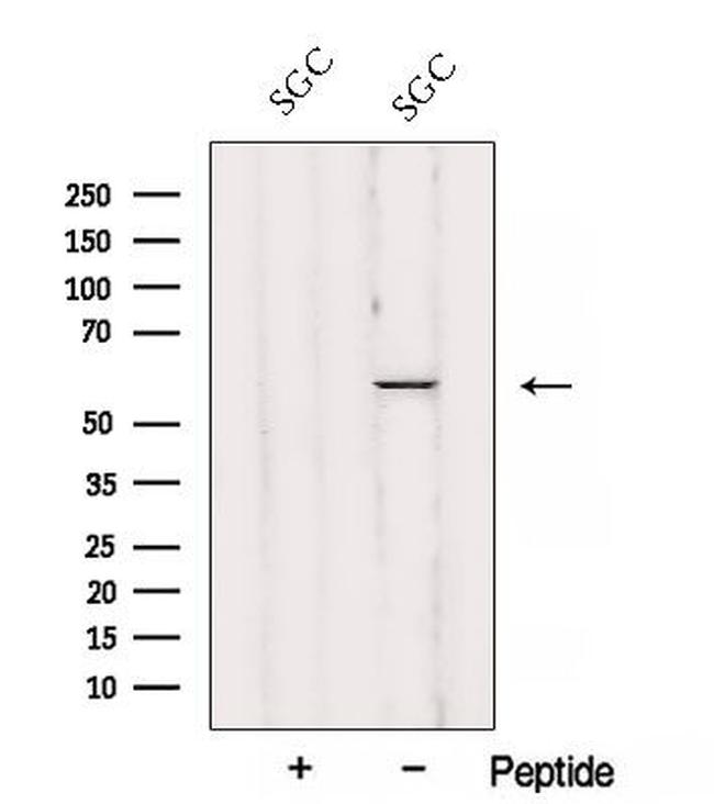 AJUBA Antibody in Western Blot (WB)