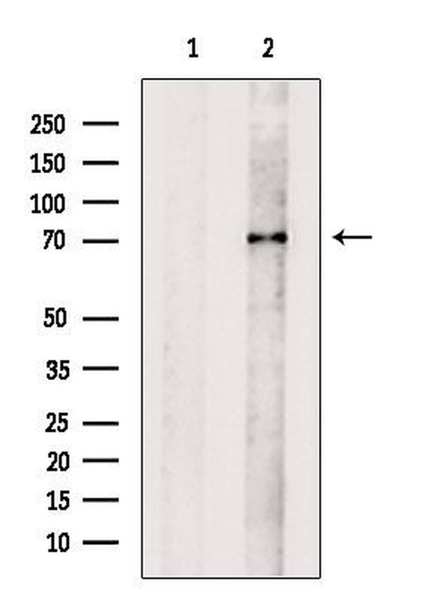 alpha Amylase 2B Antibody in Western Blot (WB)