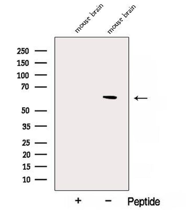 NAE1 Antibody in Western Blot (WB)