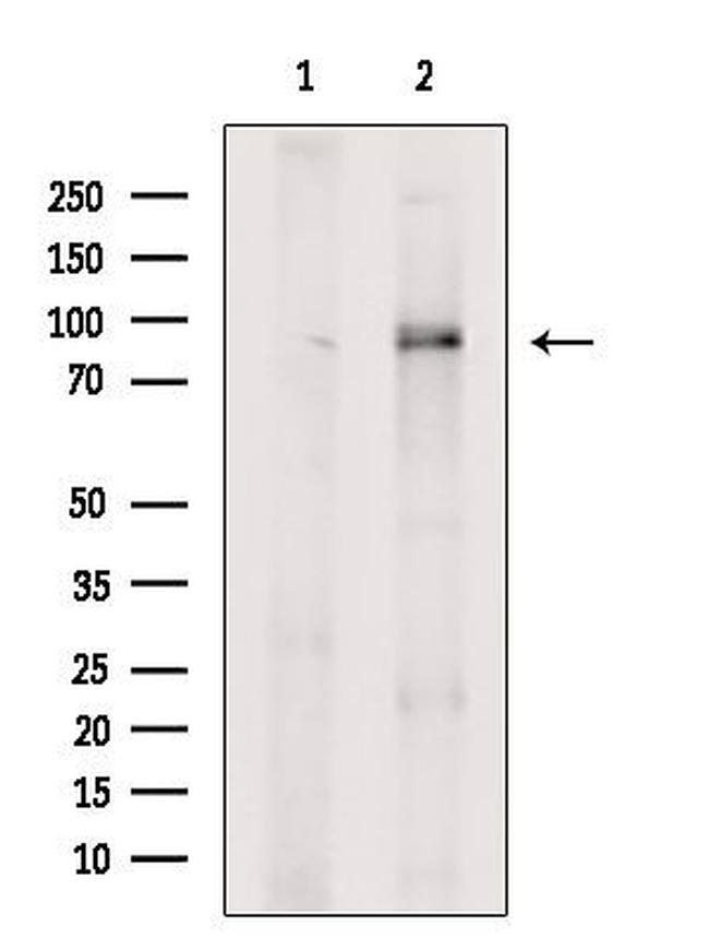 ARHGAP21 Antibody in Western Blot (WB)