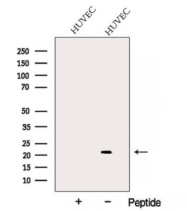 ARL7 Antibody in Western Blot (WB)